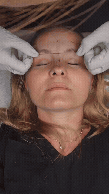 OM SPA Procedure Live Motion Highlight 01