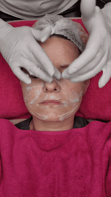 OM SPA Procedure Live Motion Highlight 03